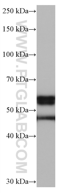 Western Blot (WB) analysis of rat cerebellum tissue using CaMKII alpha Monoclonal antibody (66843-1-Ig)