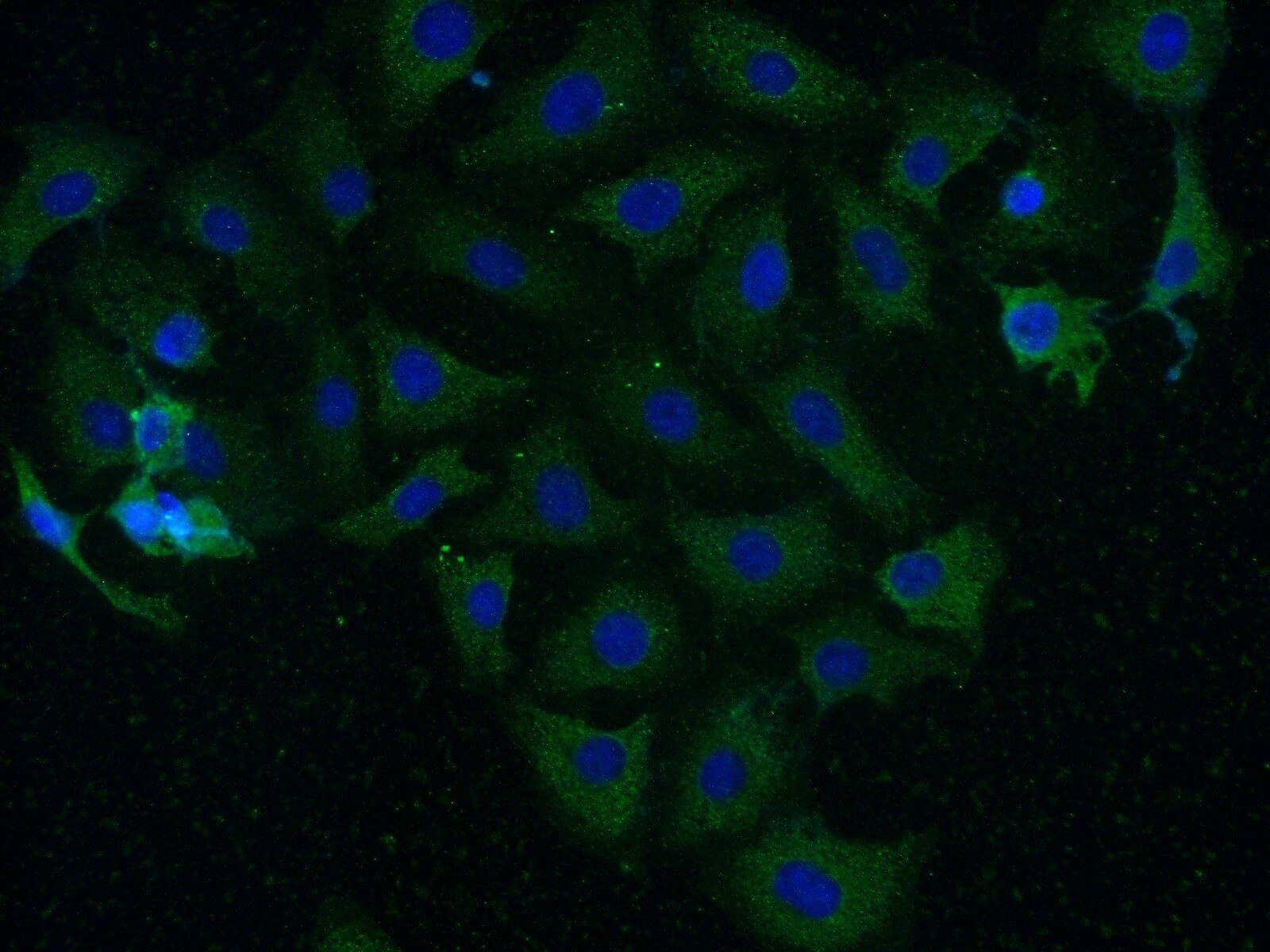 Immunofluorescence (IF) / fluorescent staining of SH-SY5Y cells using CAMK2 Polyclonal antibody (13730-1-AP)