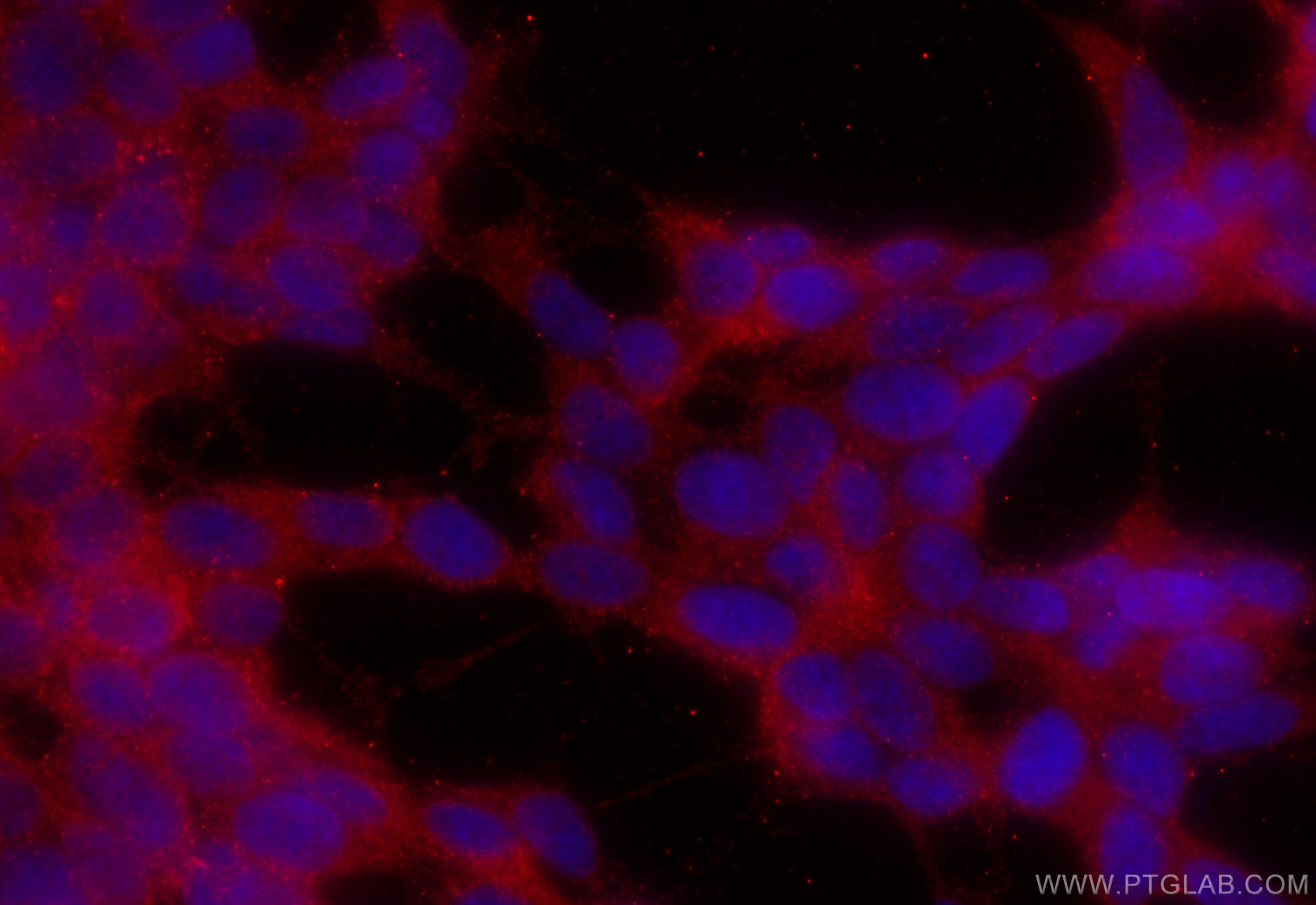 Immunofluorescence (IF) / fluorescent staining of SH-SY5Y cells using CaMKII alpha Polyclonal antibody (13730-1-AP)