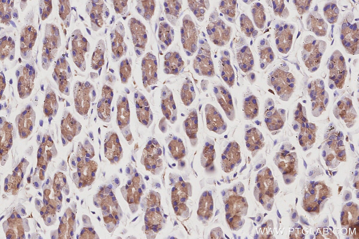 Immunohistochemistry (IHC) staining of rat stomach tissue using CaMK2 alpha Polyclonal antibody (13730-1-AP)