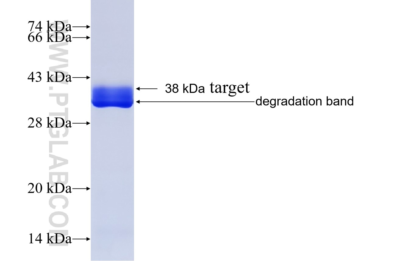 CAMK2A fusion protein Ag4736 SDS-PAGE