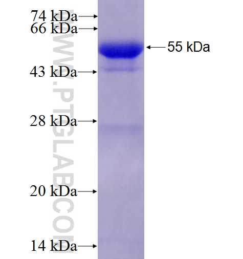 CAMK2A fusion protein Ag4745 SDS-PAGE