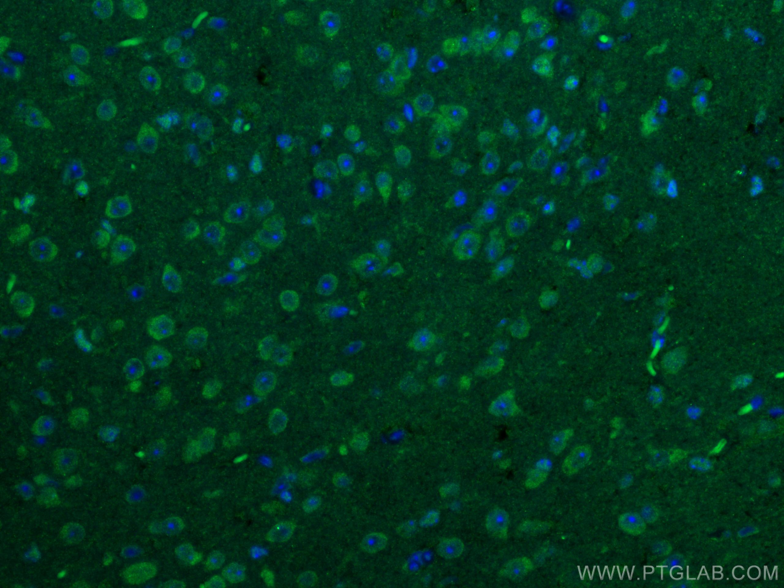 Immunofluorescence (IF) / fluorescent staining of mouse brain tissue using CaMKII alpha-Specific Polyclonal antibody (20666-1-AP)