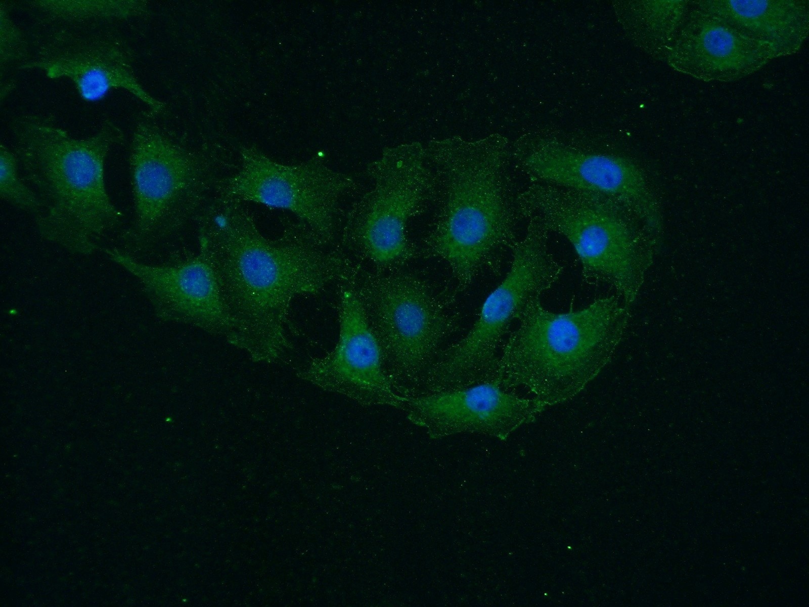 IF Staining of SH-SY5Y using 20666-1-AP