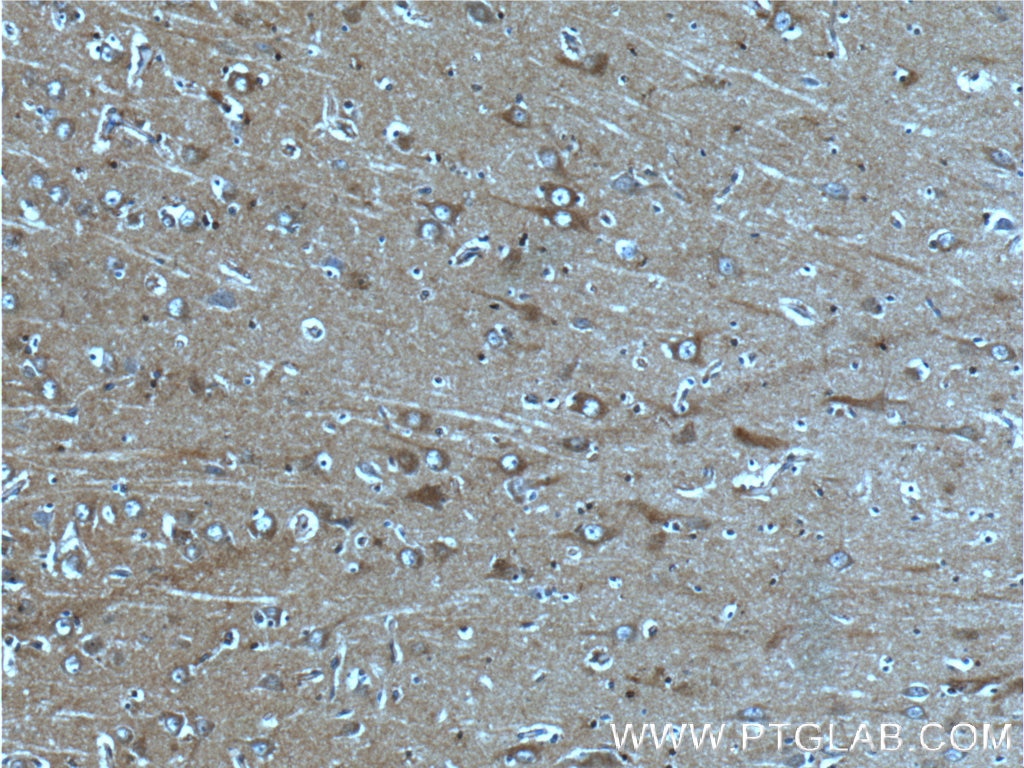 Immunohistochemistry (IHC) staining of human brain tissue using CaMKII alpha-Specific Polyclonal antibody (20666-1-AP)