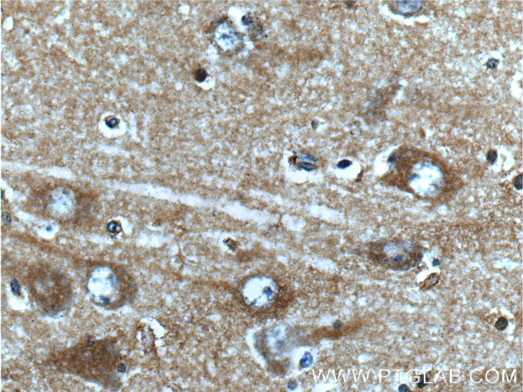 Immunohistochemistry (IHC) staining of human brain tissue using CaMKII alpha-Specific Polyclonal antibody (20666-1-AP)