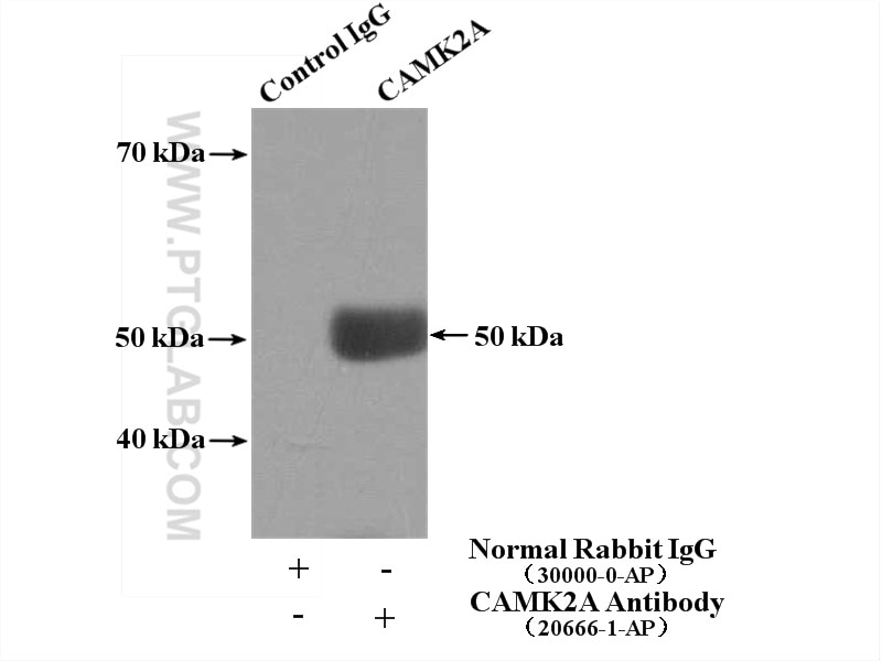 Immunoprecipitation (IP) experiment of HEK-293 cells using CaMKII alpha-Specific Polyclonal antibody (20666-1-AP)