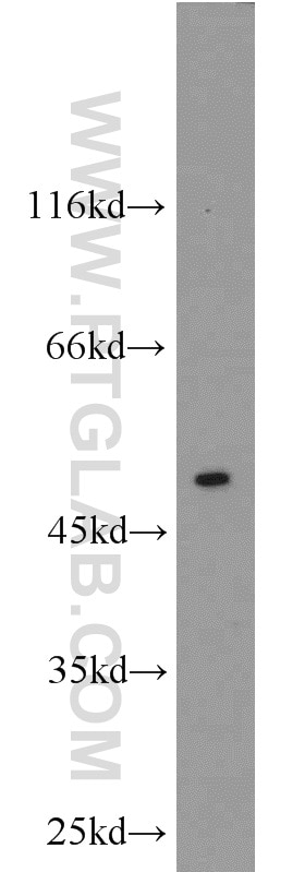 Western Blot (WB) analysis of HEK-293 cells using CaMKII alpha-Specific Polyclonal antibody (20666-1-AP)