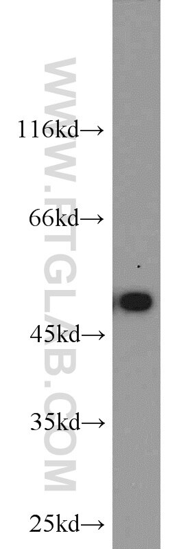 Western Blot (WB) analysis of HEK-293 cells using CaMKII alpha-Specific Polyclonal antibody (20666-1-AP)