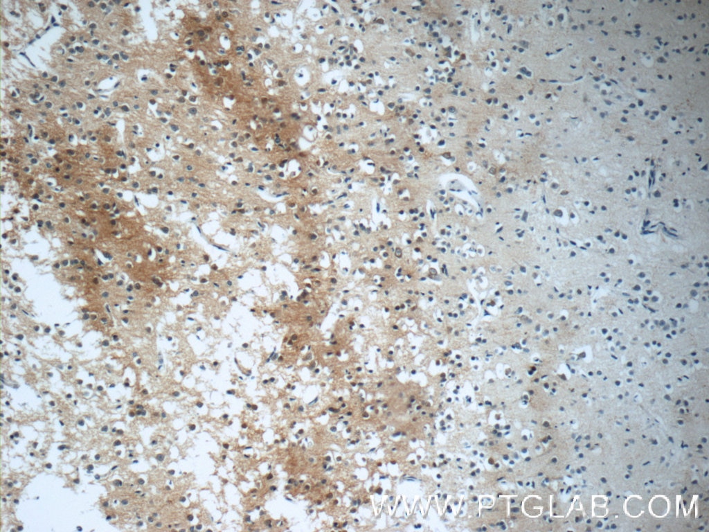 Immunohistochemistry (IHC) staining of human brain tissue using CaMKII Beta Polyclonal antibody (11533-1-AP)