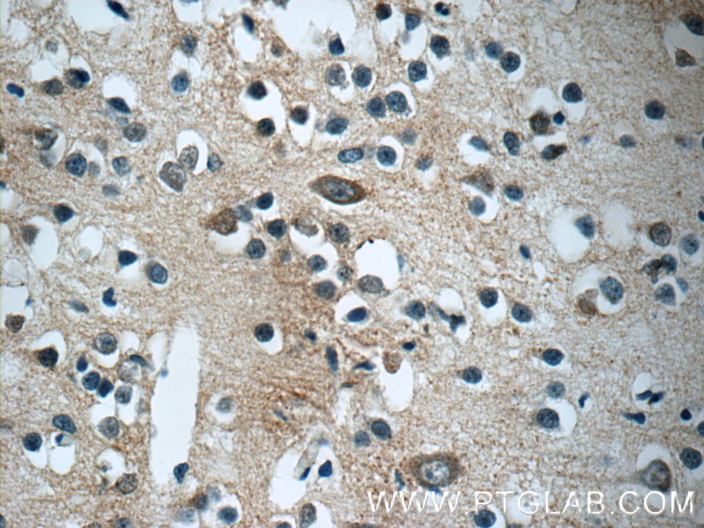 Immunohistochemistry (IHC) staining of human brain tissue using CaMKII Beta Polyclonal antibody (11533-1-AP)