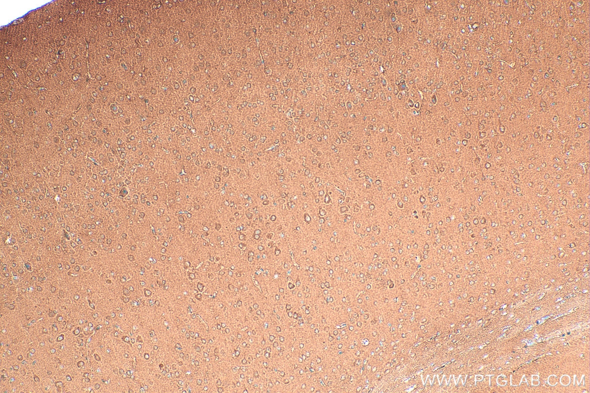 Immunohistochemistry (IHC) staining of mouse brain tissue using CAMK2B Polyclonal antibody (11533-1-AP)
