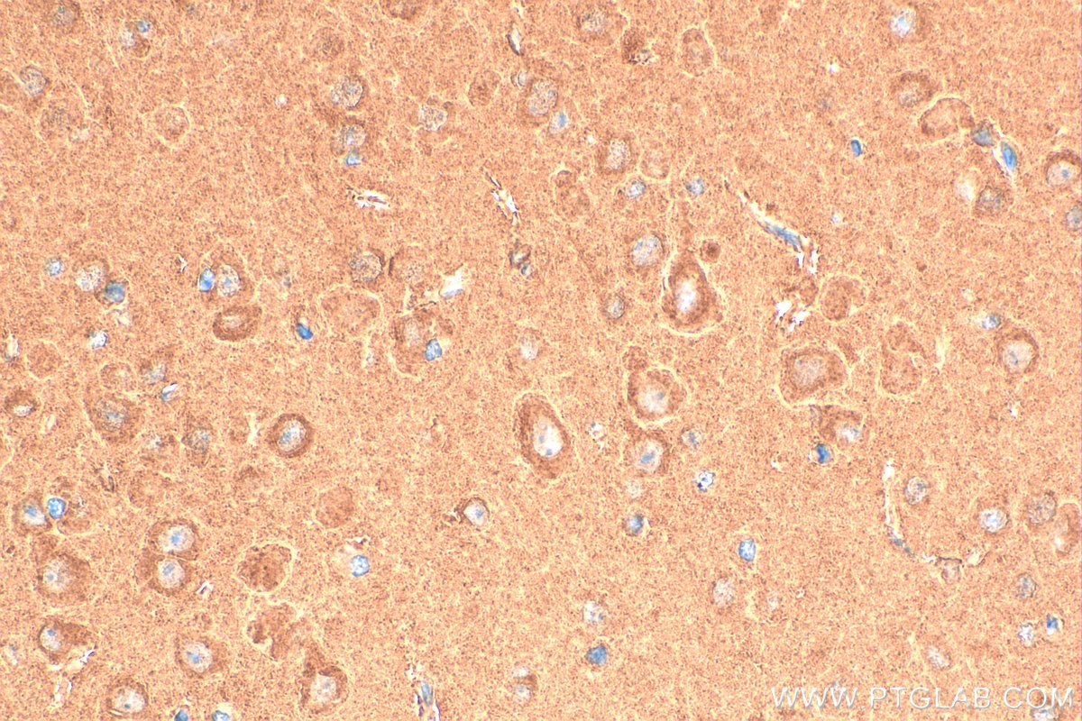 Immunohistochemistry (IHC) staining of mouse brain tissue using CAMK2B Polyclonal antibody (11533-1-AP)