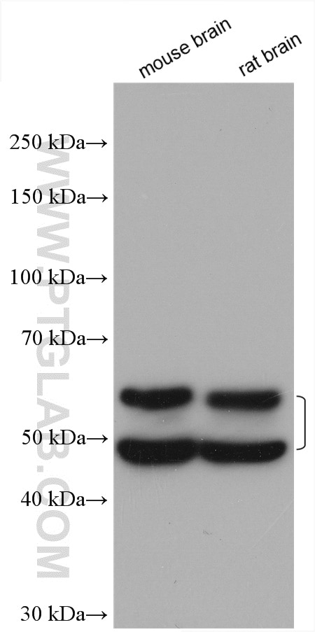 Western Blot (WB) analysis of various lysates using CaMKII Beta Polyclonal antibody (11533-1-AP)