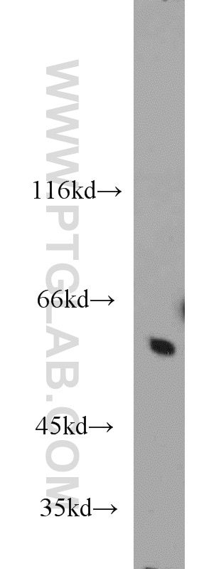Western Blot (WB) analysis of human brain tissue using CaMKII Beta Polyclonal antibody (11533-1-AP)