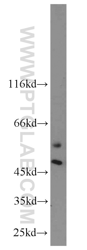 WB analysis of SH-SY5Y using 11533-1-AP