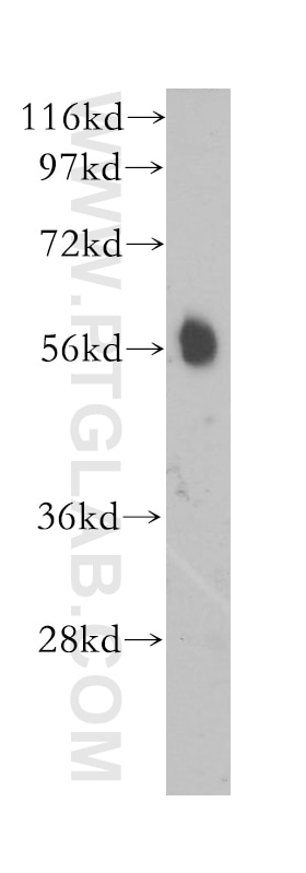 Western Blot (WB) analysis of human brain tissue using CaMKII Beta Polyclonal antibody (11533-1-AP)