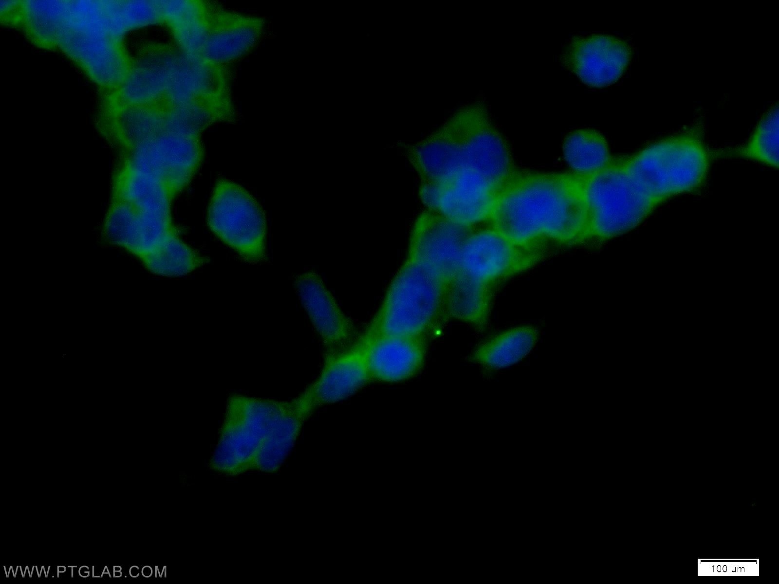 Immunofluorescence (IF) / fluorescent staining of HEK-293 cells using CaMKII beta-Specific Polyclonal antibody (55218-1-AP)