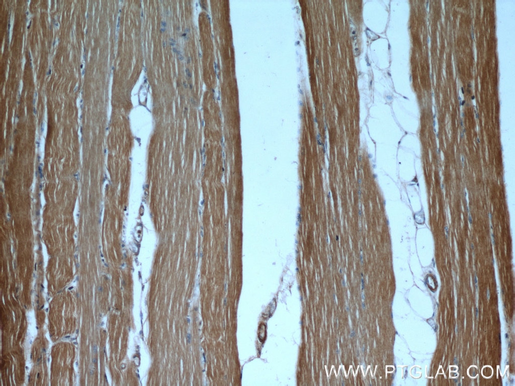 Immunohistochemistry (IHC) staining of human skeletal muscle tissue using CaMKII beta-Specific Polyclonal antibody (55218-1-AP)