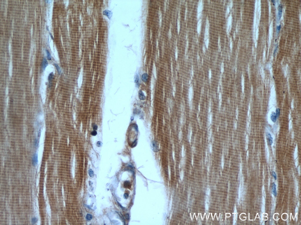 Immunohistochemistry (IHC) staining of human skeletal muscle tissue using CaMKII beta-Specific Polyclonal antibody (55218-1-AP)