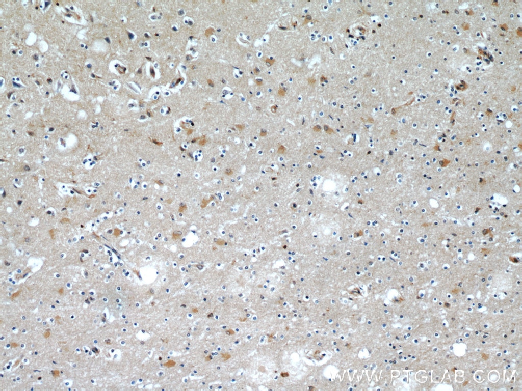 Immunohistochemistry (IHC) staining of human brain tissue using CaMKII beta-Specific Polyclonal antibody (55218-1-AP)