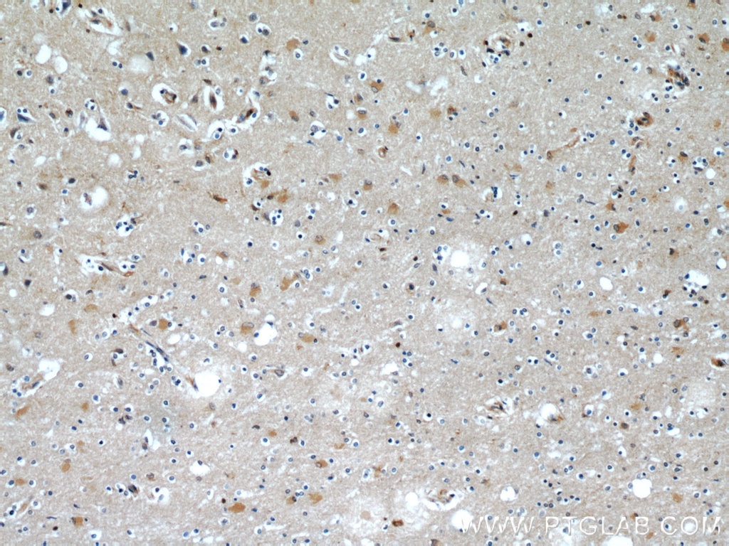 Immunohistochemistry (IHC) staining of human brain tissue using CaMKII beta-Specific Polyclonal antibody (55218-1-AP)