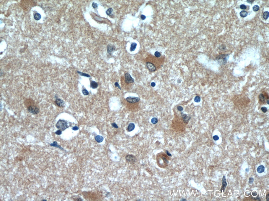 Immunohistochemistry (IHC) staining of human brain tissue using CaMKII beta-Specific Polyclonal antibody (55218-1-AP)