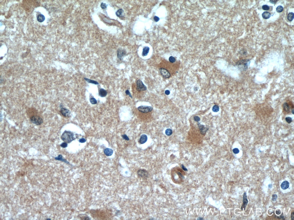 IHC staining of human brain using 55218-1-AP