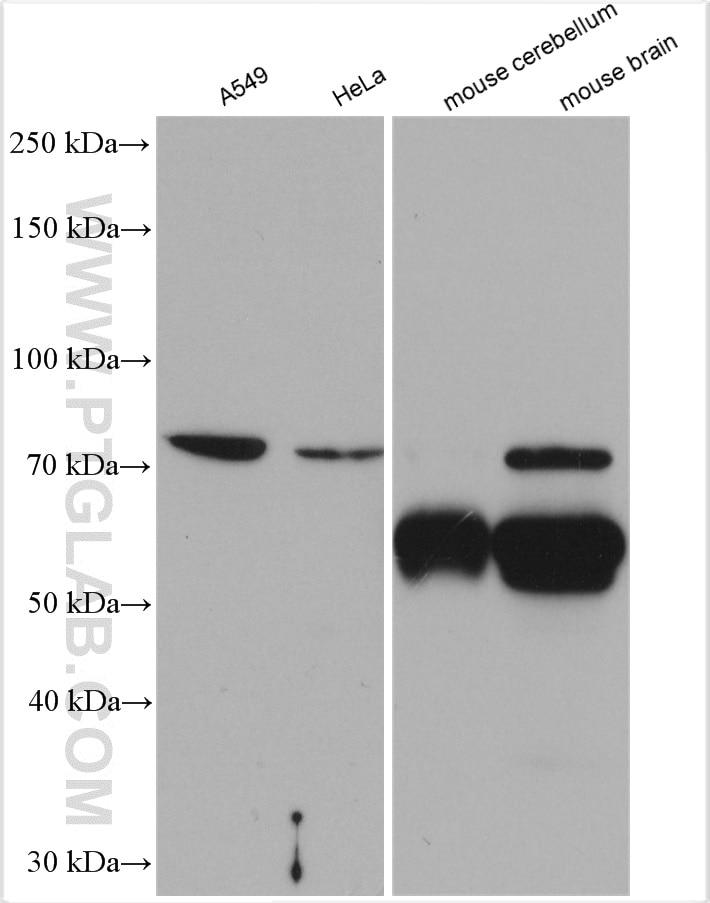 Western Blot (WB) analysis of various lysates using CaMKII beta-Specific Polyclonal antibody (55218-1-AP)
