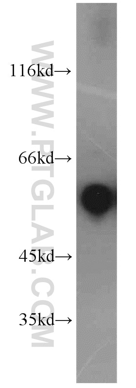 CaMKII beta-Specific