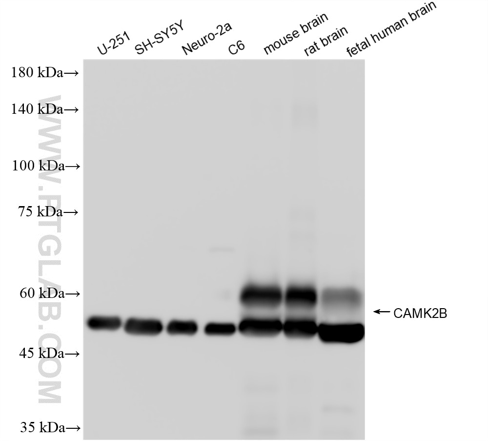 Western Blot (WB) analysis of U-251 cells using CAMK2B Recombinant monoclonal antibody (86858-1-RR)