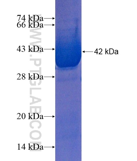 CAMK2B fusion protein Ag21704 SDS-PAGE