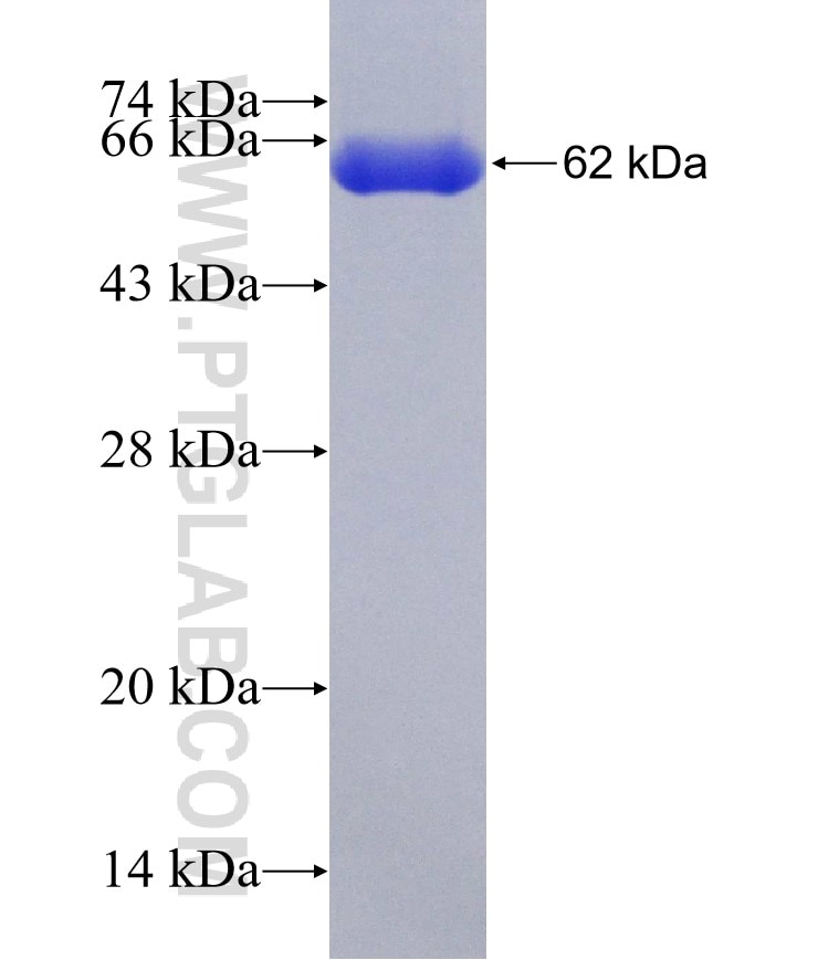 CAMK2B fusion protein Ag2119 SDS-PAGE