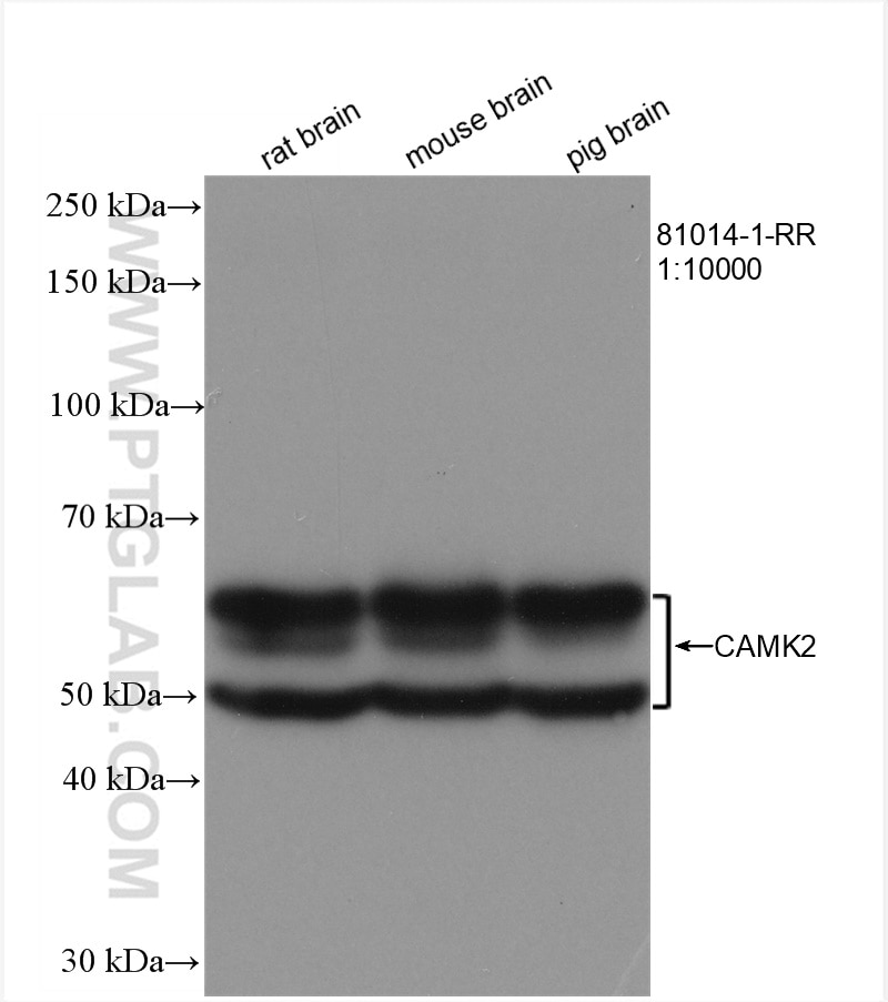 Western Blot (WB) analysis of various lysates using CAMK2D Recombinant antibody (81014-1-RR)