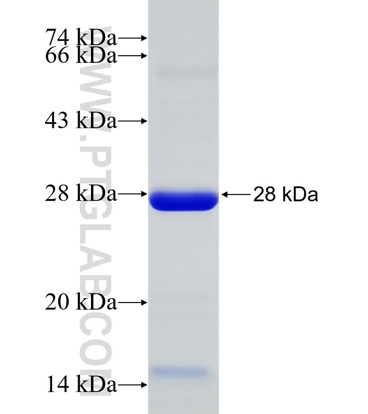 CAMK2D fusion protein Ag31276 SDS-PAGE