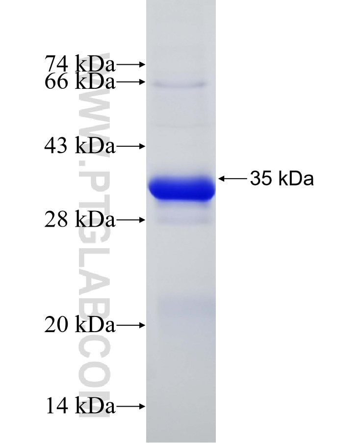 CAMK2D fusion protein Ag7323 SDS-PAGE