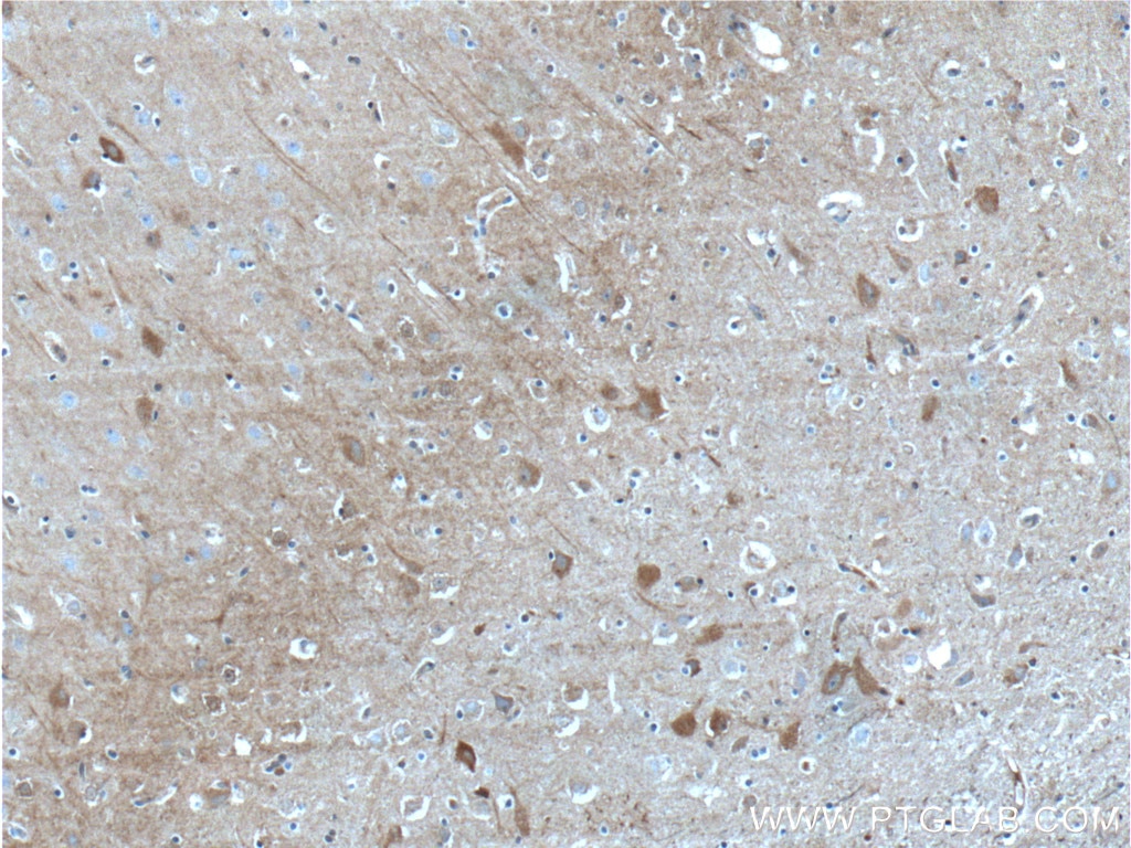 Immunohistochemistry (IHC) staining of human brain tissue using CaMKII delta-Specific Polyclonal antibody (20667-1-AP)