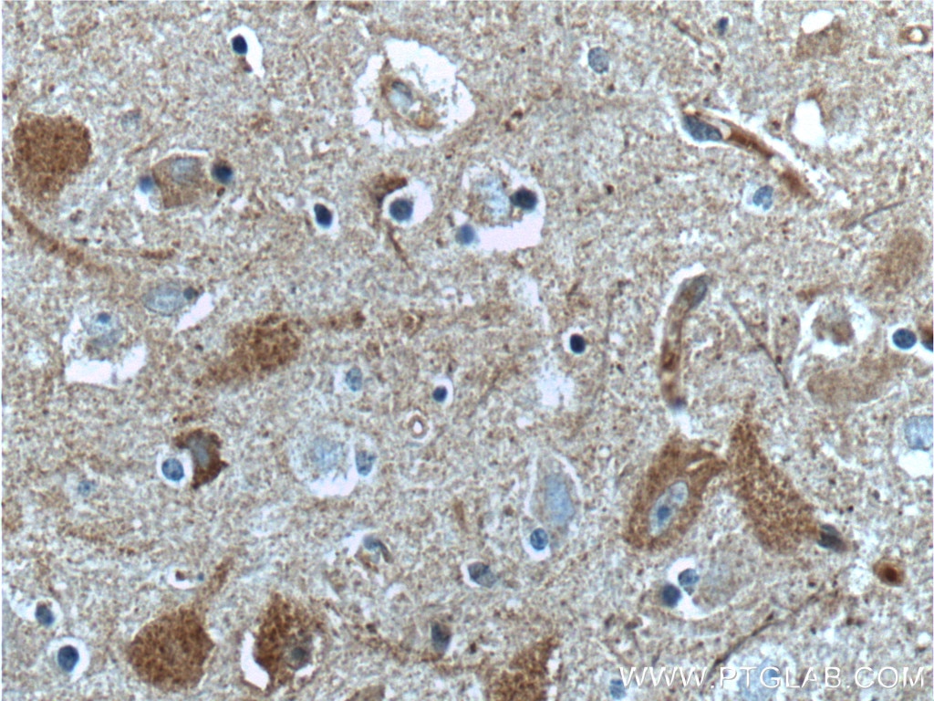 Immunohistochemistry (IHC) staining of human brain tissue using CaMKII delta-Specific Polyclonal antibody (20667-1-AP)