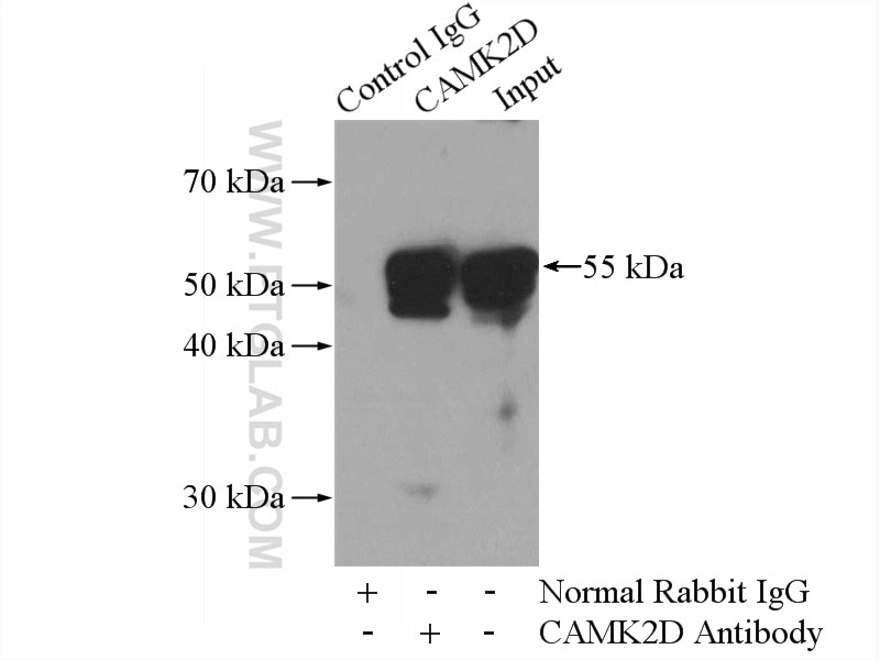 Immunoprecipitation (IP) experiment of rat brain tissue using CaMKII delta-Specific Polyclonal antibody (20667-1-AP)
