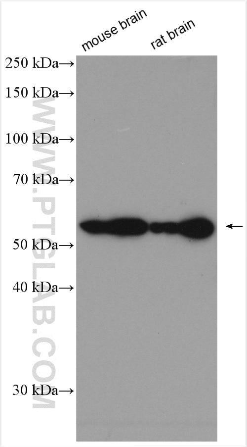 Western Blot (WB) analysis of various lysates using CaMKII delta-Specific Polyclonal antibody (20667-1-AP)