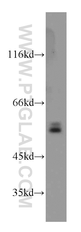 Western Blot (WB) analysis of mouse skeletal muscle tissue using CaMKII delta-Specific Polyclonal antibody (20667-1-AP)
