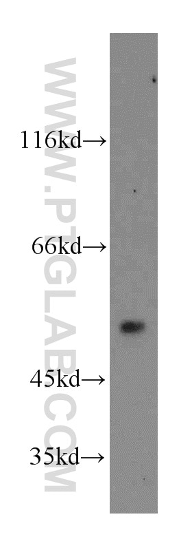 Western Blot (WB) analysis of mouse heart tissue using CaMKII delta-Specific Polyclonal antibody (20667-1-AP)