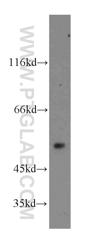 WB analysis of mouse heart using 20667-1-AP