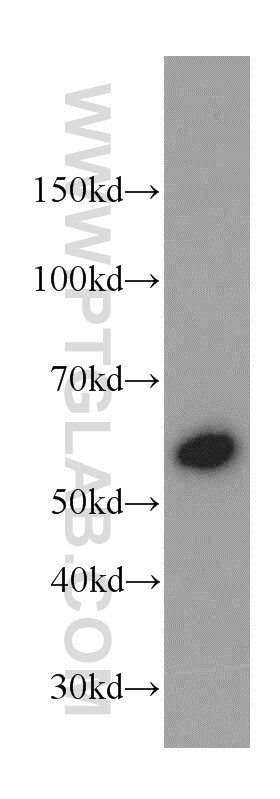 Western Blot (WB) analysis of human skeletal muscle tissue using CaMKII delta-Specific Polyclonal antibody (20667-1-AP)