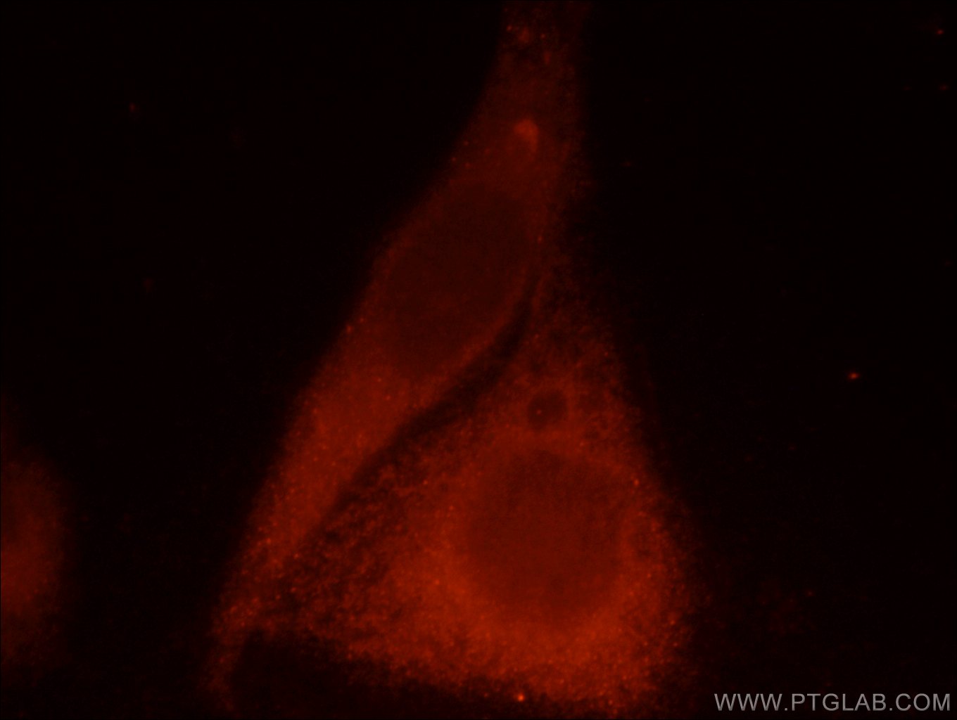 Immunofluorescence (IF) / fluorescent staining of HepG2 cells using CaMKII Gamma Polyclonal antibody (12666-2-AP)