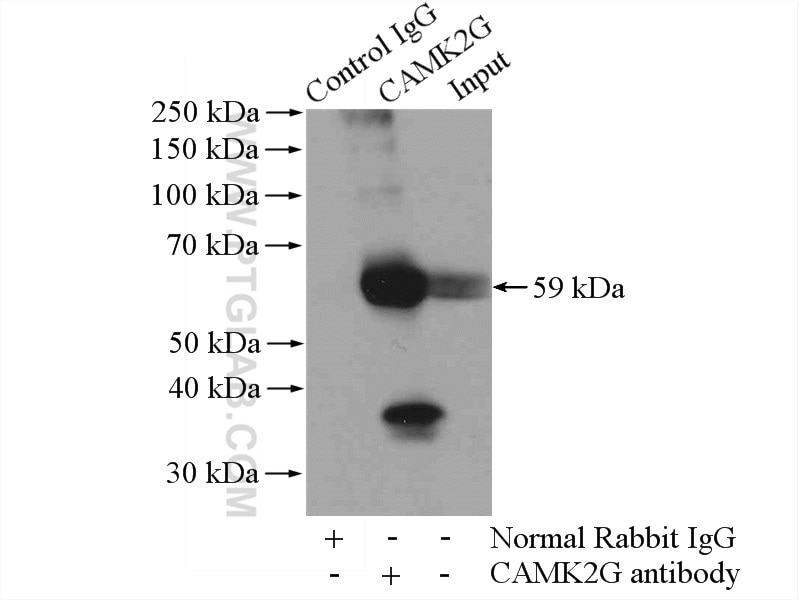 Immunoprecipitation (IP) experiment of mouse heart tissue using CaMKII Gamma Polyclonal antibody (12666-2-AP)