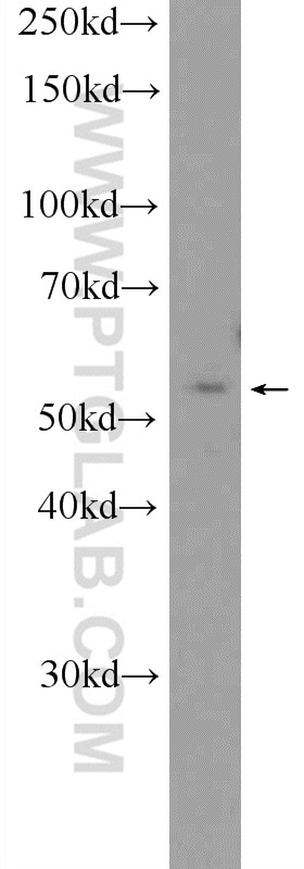 Western Blot (WB) analysis of SMMC-7721 cells using CaMKII Gamma Polyclonal antibody (12666-2-AP)