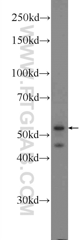 Western Blot (WB) analysis of SMMC-7721 cells using CaMKII Gamma Polyclonal antibody (12666-2-AP)