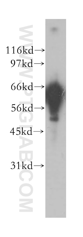 Western Blot (WB) analysis of human brain tissue using CaMKII Gamma Polyclonal antibody (12666-2-AP)