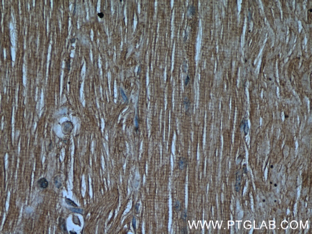 IHC staining of human skeletal muscle using 55140-1-AP